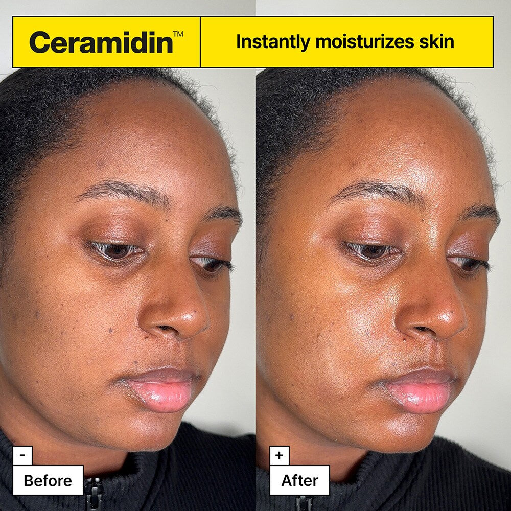 Ceramidin™ Skin Barrier Moisturizing Cream